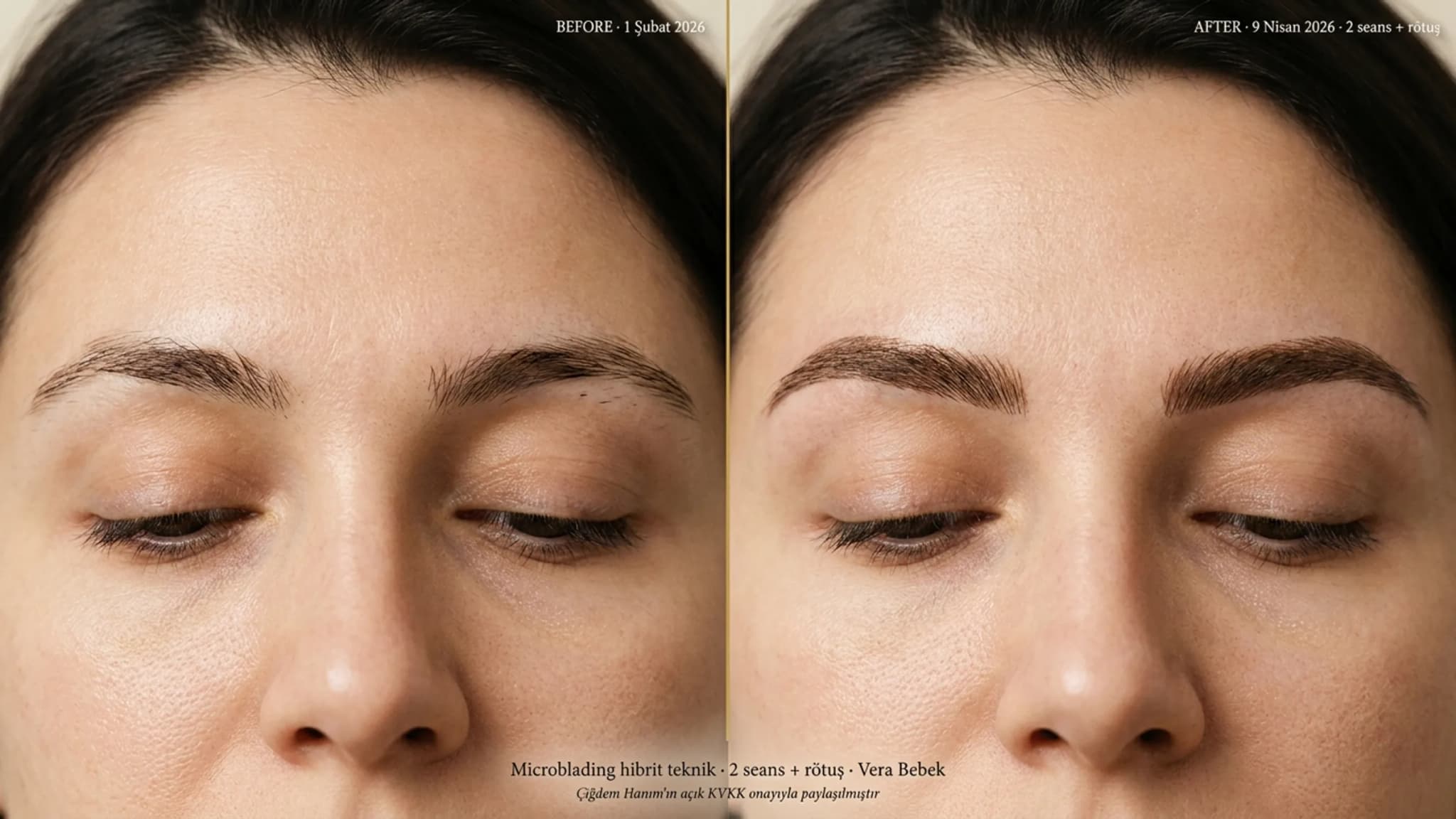 Çiğdem Hanım microblading hibrit teknik 2 seans + rötuş before/after brow close-up editorial