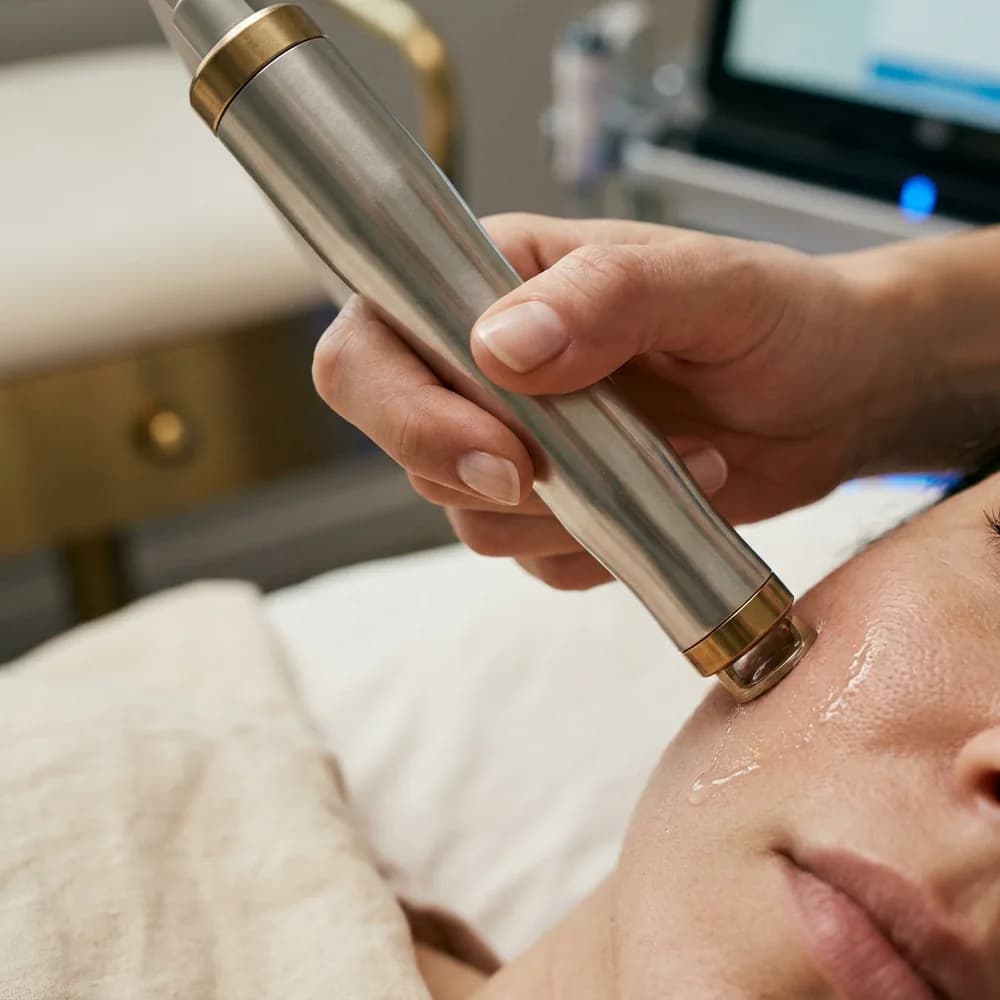 HydraFacial procedure midway, vortex probe head, Türk uzman el, mid-procedure radiant cilt